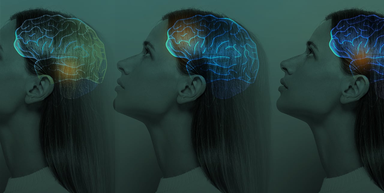 side view of girl's face with brain area highlighted in color